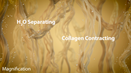 How Thermage works